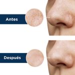 Paquete-Mascarillas-Nasales-Miniso-Puntos-Negros-Acido-Lactobi-nico-5-Piezas-6-15469