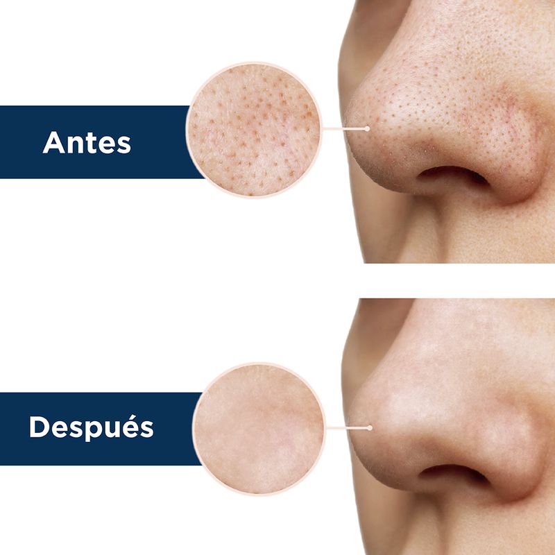 Paquete-Mascarillas-Nasales-Miniso-Puntos-Negros-Acido-Lactobi-nico-5-Piezas-6-15469